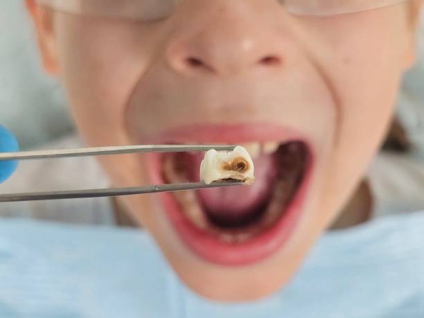 Best Urgent Dental Care  in Cooper, TX